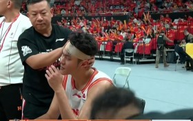 记者：王浩然的头部缝了3针 史密斯接受了核磁共振检查