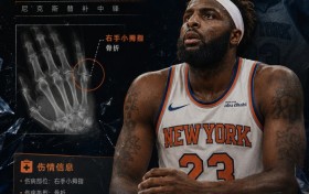 都到这时候了！尼克斯中锋米切罗右手小拇指骨折 暂无回归时间表